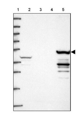 Cytochrome P450 2D6 Antibody, Novus Biologicals 25 &mu;L, Unconjugated:Antibodies,