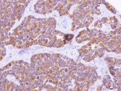 Cytochrome P450 4F11 Antibody, Novus Biologicals 0.1mL; Unlabeled:Antibodies,