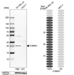 Cytochrome b reductase 1 Antibody, Novus Biologicals 25 &mu;L; Unlabeled:Antibodies,