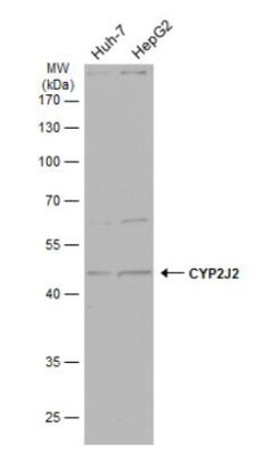 Cytochrome p450 2J2 Antibody, Novus Biologicals 0.1mL; Unlabeled:Antibodies,