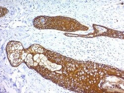 Cytokeratin, HMW Antibody (KRTH/1076), Novus Biologicals 0.2mg; Unlabeled:Antibodies,