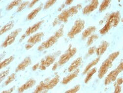 Cytokeratin, HMW Antibody (KRTH/1076), Novus Biologicals 0.2mg; Unlabeled:Antibodies,