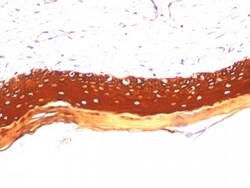 Cytokeratin, LMW Antibody (KRTL/1077), Novus Biologicals 0.2mg; Unlabeled:Antibodies,