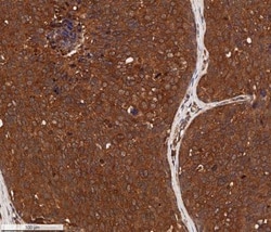 Cytokeratin 1 Antibody (LHK1) - BSA Free, Novus Biologicals 0.1mL; Unlabeled:Antibodies,