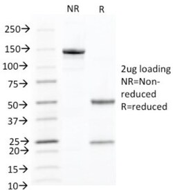 Cytokeratin 10 Antibody (KRT10/844), Novus Biologicals 0.2mg; Unlabeled:Antibodies,