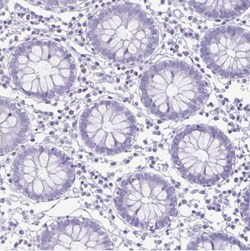 Cytokeratin 10 Antibody, Novus Biologicals 25 &mu;L; Unlabeled:Antibodies,