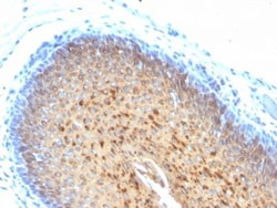 Cytokeratin 10 Antibody (KRT10/844 + KRT10/1275), Novus Biologicals 0.2mg;