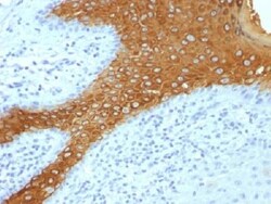 Cytokeratin 10 Antibody (KRT10/844 + KRT10/1275), Novus Biologicals 0.2mg;