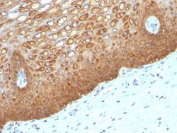 Cytokeratin 14 Antibody (KRT14/532), Novus Biologicals 0.2mg; Unlabeled:Antibodies,