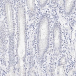 Cytokeratin 15 Antibody, Novus Biologicals 25 &mu;L; Unlabeled:Antibodies,