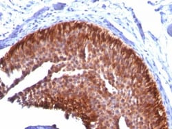Cytokeratin 17 Antibody (KRT17/778), Novus Biologicals 0.2mg; Unlabeled:Antibodies,