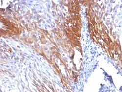 Cytokeratin 17 Antibody (KRT17/778), Novus Biologicals 0.2mg; Unlabeled:Antibodies,