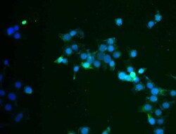 Cytokeratin 17 Antibody, Novus Biologicals 0.1mL; Unlabeled:Antibodies,