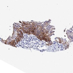 Cytokeratin 17 Antibody, Novus Biologicals 0.1mL; Unlabeled:Antibodies,