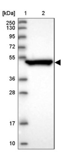 Cytokeratin 17 Antibody, Novus Biologicals 0.1mL; Unlabeled:Antibodies,