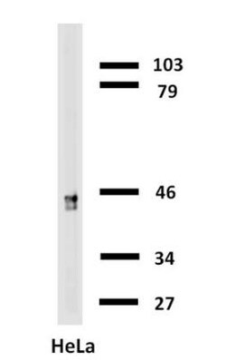 Cytokeratin 18 Antibody (C-04) - BSA Free, Novus Biologicals 0.1mg; Unlabeled:Antibodies,