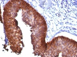 Cytokeratin 18 Antibody (KRT18/835), Novus Biologicals 0.2mg; Unlabeled:Antibodies,