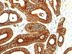 Cytokeratin 18 Antibody (KRT18/835), Novus Biologicals 0.2mg; Unlabeled:Antibodies,