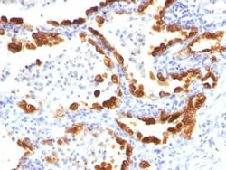 Cytokeratin 18 Antibody (KRT18/835), Novus Biologicals 0.2mg; Unlabeled:Antibodies,