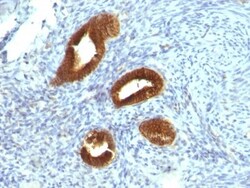Cytokeratin 19 Antibody (KRT19/799), Novus Biologicals 0.2mg; Unlabeled:Antibodies,