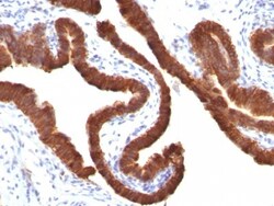 Cytokeratin 19 Antibody (KRT19/799), Novus Biologicals 0.2mg; Unlabeled:Antibodies,