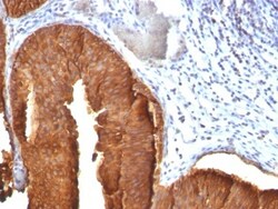 Cytokeratin 19 Antibody (KRT19/800), Novus Biologicals 0.2mg; Unlabeled:Antibodies,
