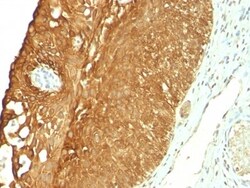 Cytokeratin 19 Antibody (KRT19/800), Novus Biologicals 0.2mg; Unlabeled:Antibodies,
