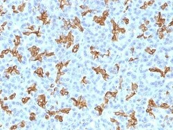 Cytokeratin 19 Antibody (KRT19/800), Novus Biologicals 0.2mg; Unlabeled:Antibodies,