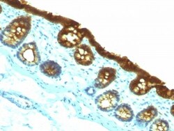 Cytokeratin 19 Antibody (KRT19/800), Novus Biologicals 0.2mg; Unlabeled:Antibodies,