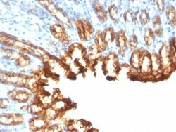Cytokeratin 19 Antibody (KRT19/800), Novus Biologicals 0.2mg; Unlabeled:Antibodies,