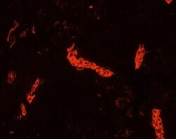 Cytokeratin 19 Antibody (RCK108) - BSA Free, Novus Biologicals 0.1mg; Unlabeled:Antibodies,
