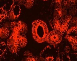 Cytokeratin 19 Antibody (RCK108) - BSA Free, Novus Biologicals 0.1mg; Unlabeled:Antibodies,