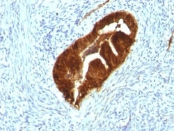 Cytokeratin 19 Antibody (KRT19/799 + KRT19/800), Novus Biologicals 0.2mg;