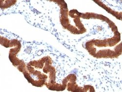Cytokeratin 19 Antibody (KRT19/799 + KRT19/800), Novus Biologicals 0.2mg;