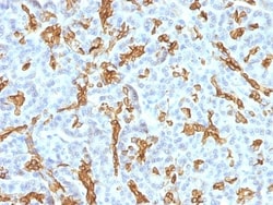 Cytokeratin 19 Antibody (KRT19/799 + KRT19/800), Novus Biologicals 0.2mg;