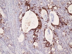 Cytokeratin 20 Antibody (E19-I), Novus Biologicals 200&mu;L; Unlabeled:Antikörper
