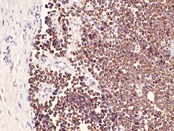 Cytokeratin 20 Antibody (E19-I), Novus Biologicals 200&mu;L; Unlabeled:Antikörper