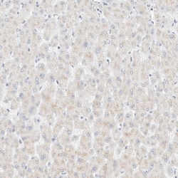 Cytokeratin 20 Antibody, Novus Biologicals 0.1mL; Unlabeled:Antibodies,