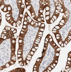 Cytokeratin 20 Antibody, Novus Biologicals 0.1mL; Unlabeled:Antibodies,