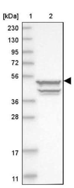 Cytokeratin 20 Antibody, Novus Biologicals 0.1mL; Unlabeled:Antibodies,