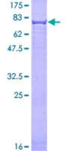 Novus Biologicals Recombinant Human Cytokeratin 4 GST (N-Term) Protein 25 &mu;g | Buy Online | Novus Biologicals&trade; | Fisher Scientific