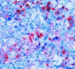 Cytokeratin 5/8 Antibody (C-50), Novus Biologicals 0.2 mg | Buy Online | Novus Biologicals | Fisher Scientific