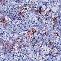 Cytokeratin 5/8 Antibody (C-50), Novus Biologicals 0.2 mg | Buy Online | Novus Biologicals | Fisher Scientific