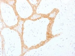 Cytokeratin 5/8 Antibody (C-50), Novus Biologicals 0.2 mg | Buy Online | Novus Biologicals | Fisher Scientific