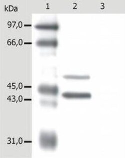Cytokeratin 5/8 Antibody (C-50), Novus Biologicals 0.2 mg | Buy Online | Novus Biologicals | Fisher Scientific