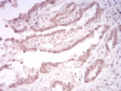 Cytokeratin 5 Antibody (2C8E4) - BSA Free, Novus Biologicals:Antibodies:Primary