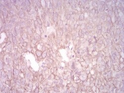 Cytokeratin 5 Antibody (3D6D4) - BSA Free, Novus Biologicals:Antibodies:Primary