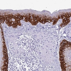 Cytokeratin 5 Antibody, Novus Biologicals 25 &mu;L, Unlabeled:Antibodies,