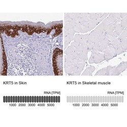 Cytokeratin 5 Antibody, Novus Biologicals 25 &mu;L, Unlabeled:Antibodies,