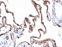 Cytokeratin 7 Antibody (KRT7/1198), Novus Biologicals 0.2mg; Unlabeled:Antibodies,